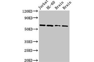 Western Blot Positive WB detected in: Jurkat whole cell lysate, HL60 whole cell lysate, Rat brain tissue, Mouse brain tissue All lanes: ARX antibody at 2.
