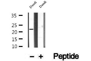 Western blot analysis of extracts of Daudi cells, using CHCHD4 antibody.