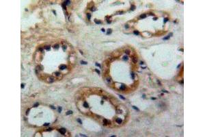 #VALUE! (CD68 antibody  (AA 27-282))