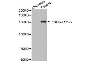 Western Blotting (WB) image for anti-Nitric Oxide Synthase 3 (Endothelial Cell) (NOS3) (pSer1177) antibody (ABIN1870485) (ENOS antibody  (pSer1177))