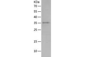 Western Blotting (WB) image for Interleukin 15 (IL15) (AA 49-162) protein (His-IF2DI Tag) (ABIN7123549) (IL-15 Protein (AA 49-162) (His-IF2DI Tag))