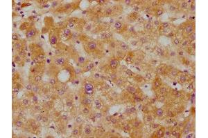 IHC image of ABIN7127423 diluted at 1:115 and staining in paraffin-embedded human liver tissue performed on a Leica BondTM system. (Recombinant CETP antibody)