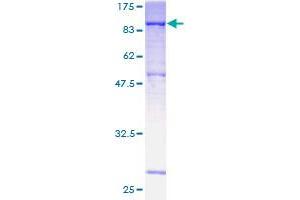DMPK Protein (AA 1-629) (GST tag)