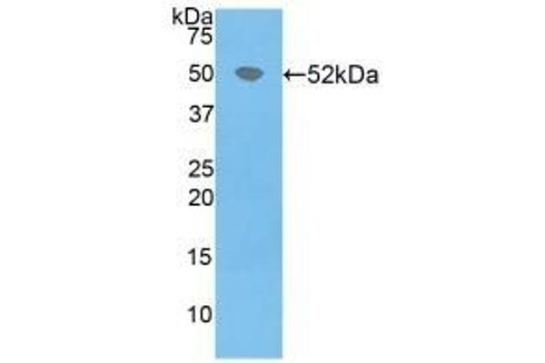 HPRT1 antibody  (AA 3-218)
