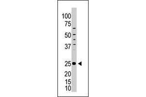 The ICOS polyclonal antibody  is used in Western blot to detect ICOS in HL-60 cell lysate. (ICOS antibody  (C-Term))