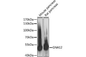 Western blot analysis of extracts of various cell lines, using GN antibody (ABIN6131706, ABIN6141192, ABIN6141193 and ABIN6217845) at 1:3000 dilution.