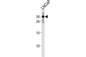 Western blot analysis in LNCaP cell line lysates (35ug/lane) using RNF4 Antibody (C-term) Cat.