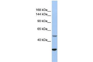 WB Suggested Anti-ZZZ3 Antibody Titration:  0. (ZZZ3 antibody  (Middle Region))
