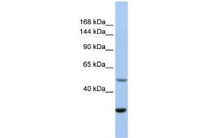 Western Blotting (WB) image for anti-Zinc Finger, ZZ-Type Containing 3 (ZZZ3) (Middle Region) antibody (ABIN2773970)