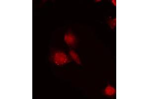 ABIN6272286 staining LOVO by IF/ICC. (RBM6 antibody  (N-Term))