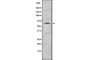 Western blot analysis of K2C1 expression in HEK293 cells ,The lane on the left is treated with the antigen-specific peptide. (Cytokeratin 1 antibody  (N-Term))