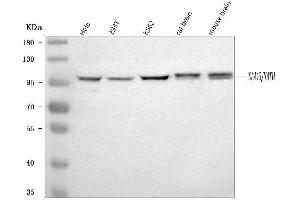 Western blot analysis of NARG1/NAA15 using anti-NARG1/NAA15 antibody (ABIN7600879).