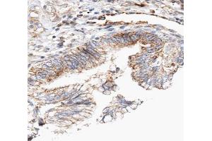 ABIN6266837 at 1/100 staining human lung tissue sections by IHC-P. (Claudin 7 antibody  (C-Term))