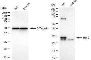 Western blotting analysis using Bcl-2 antibody (ABIN7797719). (Recombinant Bcl-2 antibody)