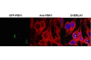 Image no. 1 for anti-Ribosomal L1 Domain Containing 1 (RSL1D1) (Internal Region) antibody (ABIN401398) (RSL1D1 antibody  (Internal Region))