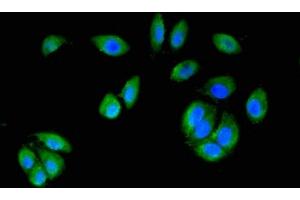 Immunofluorescence staining of A549 cells with ABIN7150721 at 1:200, counter-stained with DAPI. (MAP2K6 antibody  (AA 1-334))