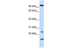 GUCA1A antibody used at 1 ug/ml to detect target protein.