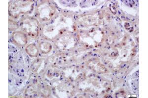 Formalin-fixed and paraffin embedded human kidney labeled with Anti-HOXC9 Polyclonal Antibody, Unconjugated (ABIN872638) at 1:200 followed by conjugation to the secondary antibody and DAB staining (HOXC9 antibody  (AA 151-220))