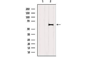 Western Blotting (WB) image for anti-Docking Protein 1, 62kDa (Downstream of tyrosine Kinase 1) (DOK1) (Internal Region) antibody (ABIN6263984)