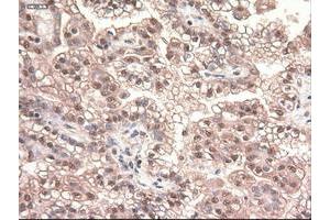 Image no. 14 for anti-Myc Proto-Oncogene protein (MYC) antibody (ABIN1497012) (c-MYC antibody)