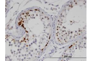 Immunoperoxidase of monoclonal antibody to SSX2 on formalin-fixed paraffin-embedded human testis. (SSX2 antibody  (AA 1-223))