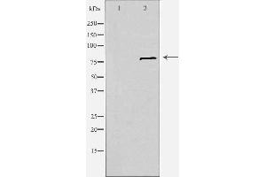 Western blot analysis of extracts from Jurkat cells, using SLC6A15 antibody.