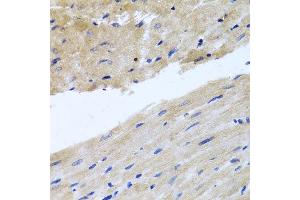 Immunohistochemistry of paraffin-embedded rat heart using RAB24 antibody at dilution of 1:100 (x40 lens).