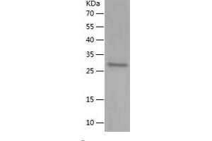 Western Blotting (WB) image for Ubiquitin-Like, Containing PHD and RING Finger Domains, 1 (UHRF1) (AA 96-297) protein (His tag) (ABIN7283402) (UHRF1 Protein (AA 96-297) (His tag))