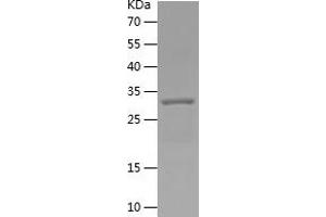 Western Blotting (WB) image for Complement Component 5a (C5a) (AA 1-77) protein (His tag) (ABIN7283259) (C5A Protein (AA 1-77) (His tag))