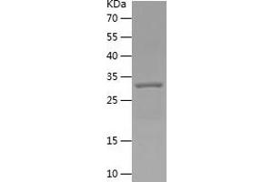 C5A Protein (AA 1-77) (His tag)