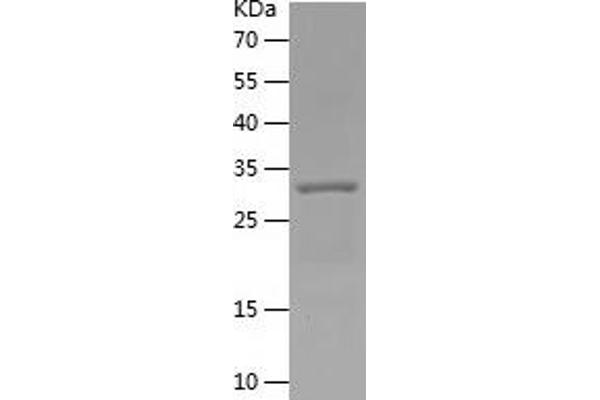 C5A Protein (AA 1-77) (His tag)