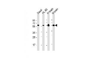All lanes : Anti-CSIN2 Antibody at 1:2000 dilution Lane 1: Daudi whole cell lysate Lane 2: HL-60 whole cell lysate Lane 3: human brain lysate Lane 4: mouse brain lysate Lysates/proteins at 20 μg per lane. (PACSIN2 antibody  (AA 250-486))