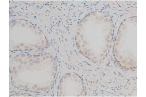 ABIN6267395 at 1/200 staining Human prostate tissue sections by IHC-P. (GATA1 antibody  (pSer142))