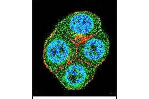 Confocal immunofluorescent analysis of BTRC Antibody (N-term) (ABIN655814 and ABIN2845238) with ZR-75-1 cell followed by Alexa Fluor 488-conjugated goat anti-rabbit lgG (green). (BTRC antibody  (N-Term))