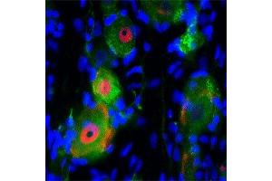 Immunofluorescence (IF) image for anti-Nerve Growth Factor Receptor (NGFR) antibody (ABIN350707)