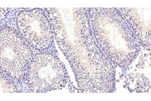 Detection of NEIL3 in Mouse Testis Tissue using Polyclonal Antibody to Nei Endonuclease VIII Like Protein 3 (NEIL3) (NEIL3 antibody  (AA 2-187))