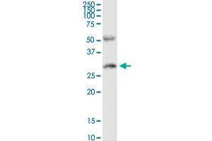PPP2R3B MaxPab rabbit polyclonal antibody. (PPP2R3B antibody  (AA 1-225))