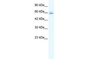 CBFA2T3 antibody  (N-Term)