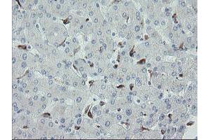 Image no. 1 for anti-Myosin Light Chain 7, Regulatory (MYL7) antibody (ABIN1499491) (MYL7 antibody)