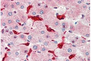 Human Liver (formalin-fixed, paraffin-embedded) stained with HMOX1 antibody ABIN462108 at 10 ug/ml followed by biotinylated goat anti-rabbit IgG secondary antibody ABIN481713, alkaline phosphatase-streptavidin and chromogen. (HMOX1 antibody)