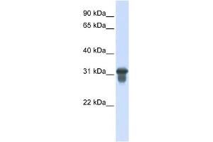 SLC25A11 antibody used at 1 ug/ml to detect target protein. (SLC25A11 antibody)