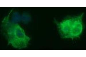 Image no. 2 for anti-Tubulin, beta 2B (TUBB2B) antibody (ABIN1501575)