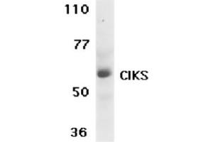 Western blot analysis of CIKS expression in human placenta tissue lysate with ABIN121600. (TRAF3IP2 antibody  (AA 554-568))