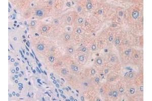 Detection of PROS in Human Liver Tissue using Polyclonal Antibody to Protein S (PROS) (PROS1 antibody  (AA 481-667))