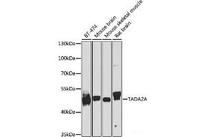 Western blot analysis of extracts of various cell lines using TADA2A Polyclonal Antibody at dilution of 1:1000. (TADA2L antibody)