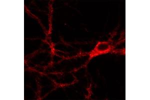Indirect immunofluorescence labeling of PFA fixed rat hippocampus neurons (dilution 1 : 500). (SNAP91 antibody  (AA 279-297))