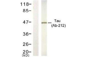 Image no. 1 for anti-Microtubule-Associated Protein tau (MAPT) (Thr212) antibody (ABIN197504) (MAPT antibody  (Thr212))