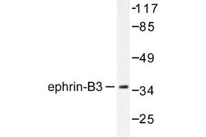 Image no. 1 for anti-Ephrin B3 (EFNB3) antibody (ABIN265403) (Ephrin B3 antibody)