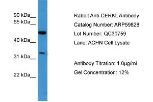 WB Suggested Anti-CERKL  Antibody Titration: 0. (CERKL antibody  (N-Term))
