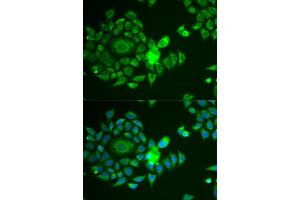 Immunofluorescence analysis of U2OS cells using NDUFS4 antibody (ABIN6132404, ABIN6144488, ABIN6144490 and ABIN6217547). (NDUFS4 antibody  (AA 1-175))